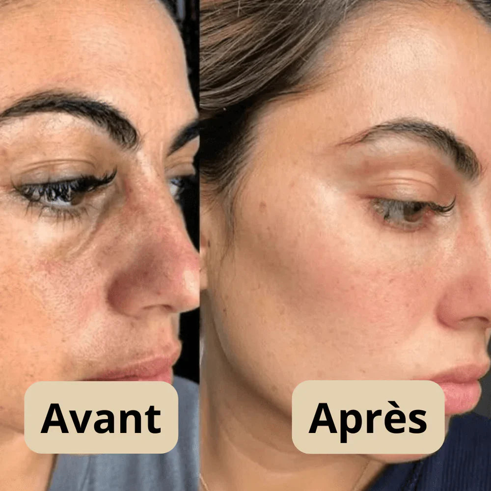 Sérum Gommant au Riz – Pour Peaux Sensibles