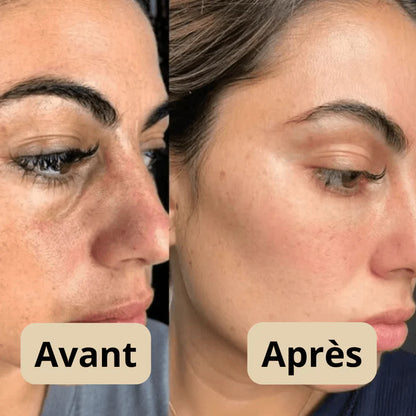 Sérum Gommant au Riz – Pour Peaux Sensibles