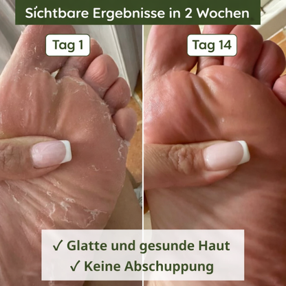 Natürliche antimykotische Seife