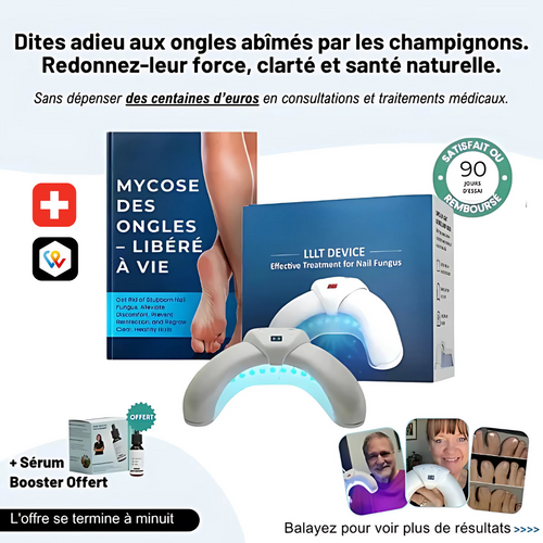 Dispositif LED anti-mycose ongles – Soins rapides et naturels