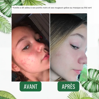 Masque Solide au Thé Vert