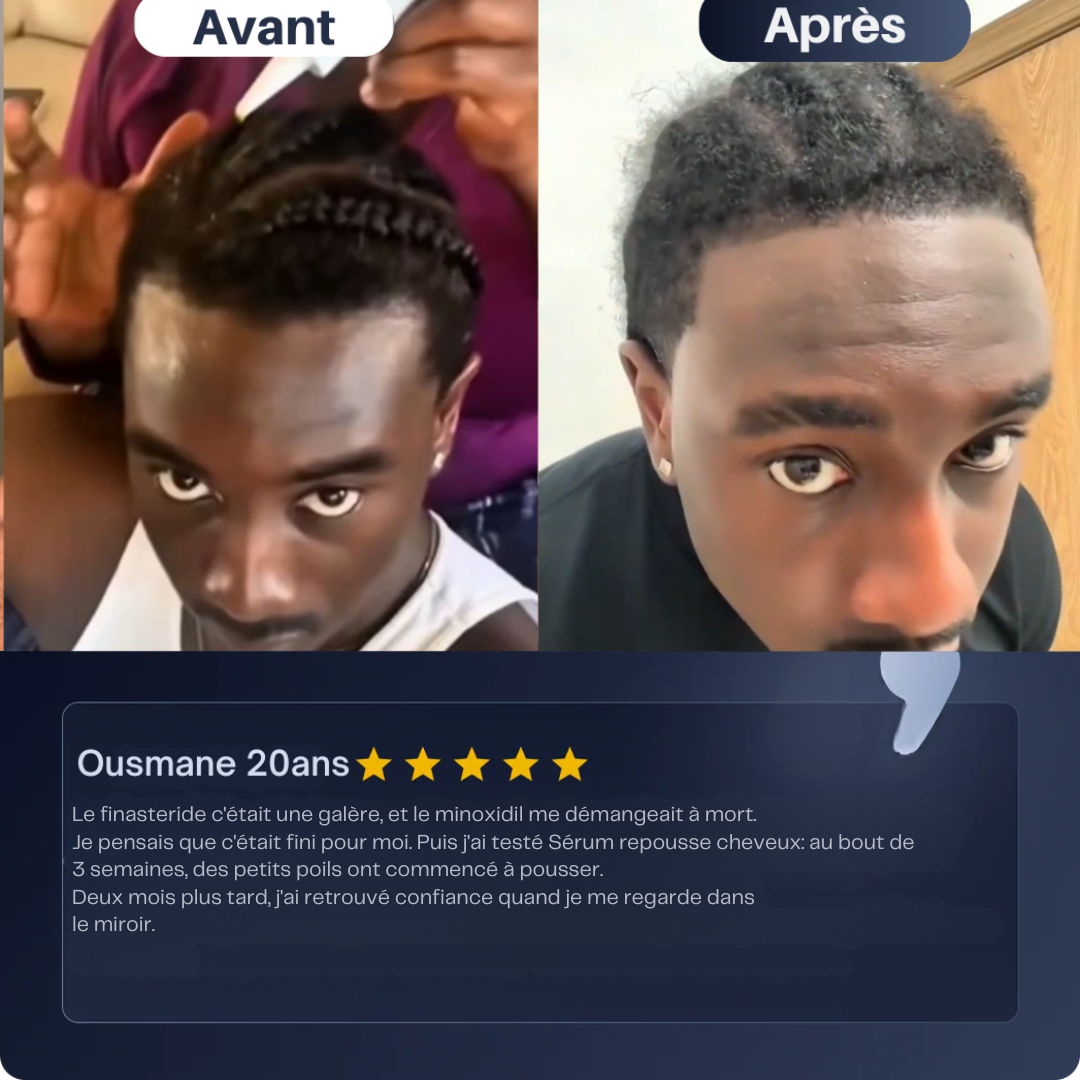 Sérum repousse cheveux