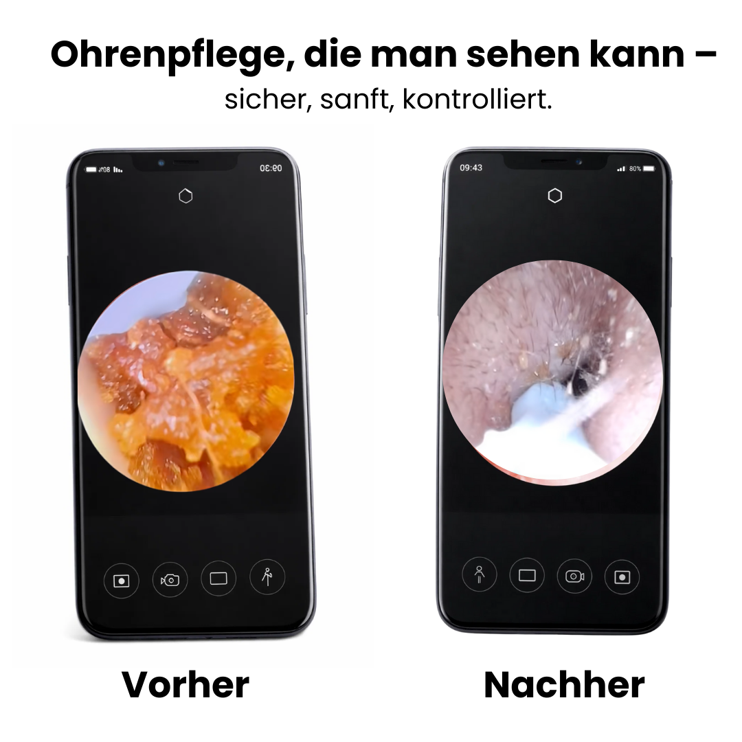 HD-vernetztes Otoskop zur Ohrreinigung