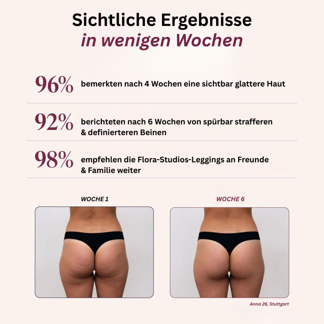 Kompressionsleggings mit formender Wirkung