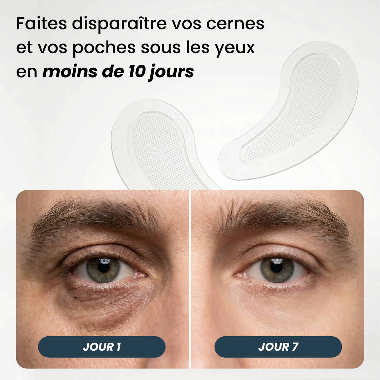 Anti-Augenringe-Patches mit Mikronadeln