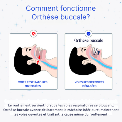 Verstellbare Mundorthese gegen Schnarchen