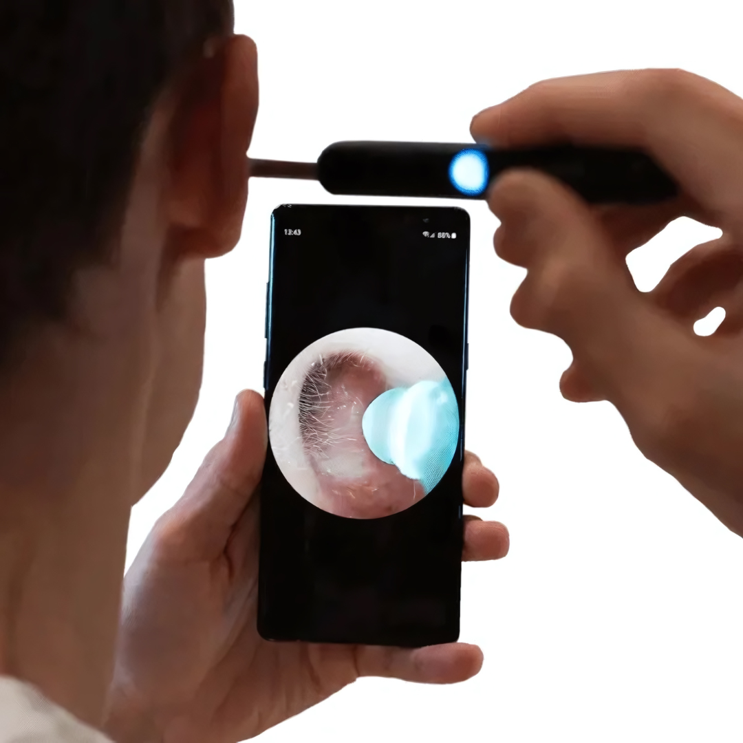 Nettoyeur d’oreille intelligent avec caméra HD