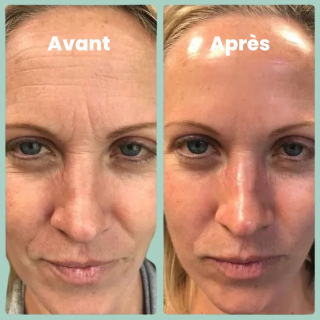 Poudre de Collagène Marin