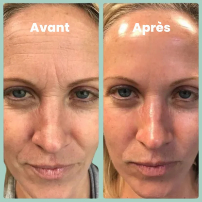 Poudre de Collagène Marin