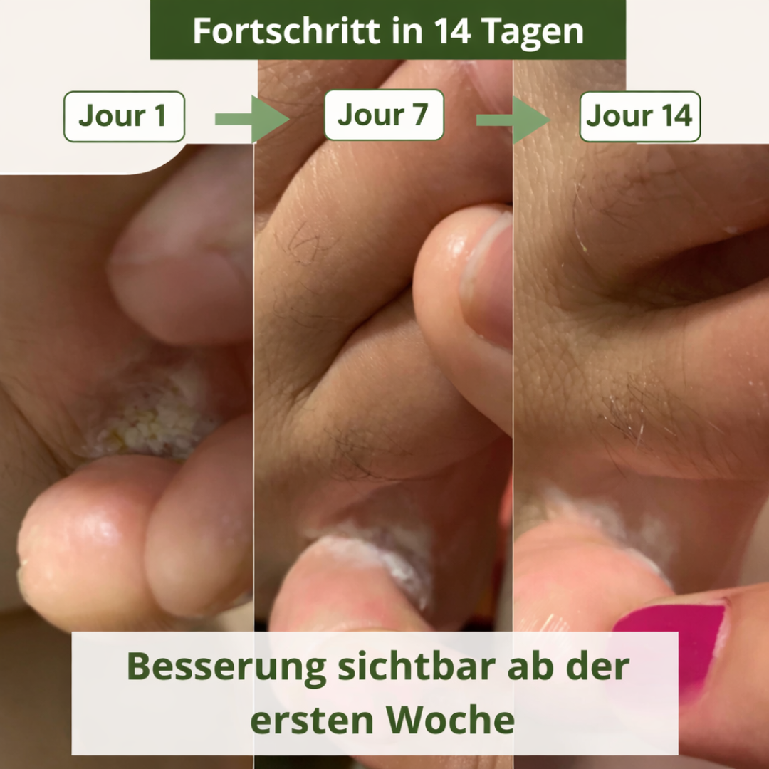 Natürliche antimykotische Seife