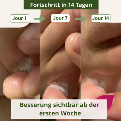 Natürliche antimykotische Seife