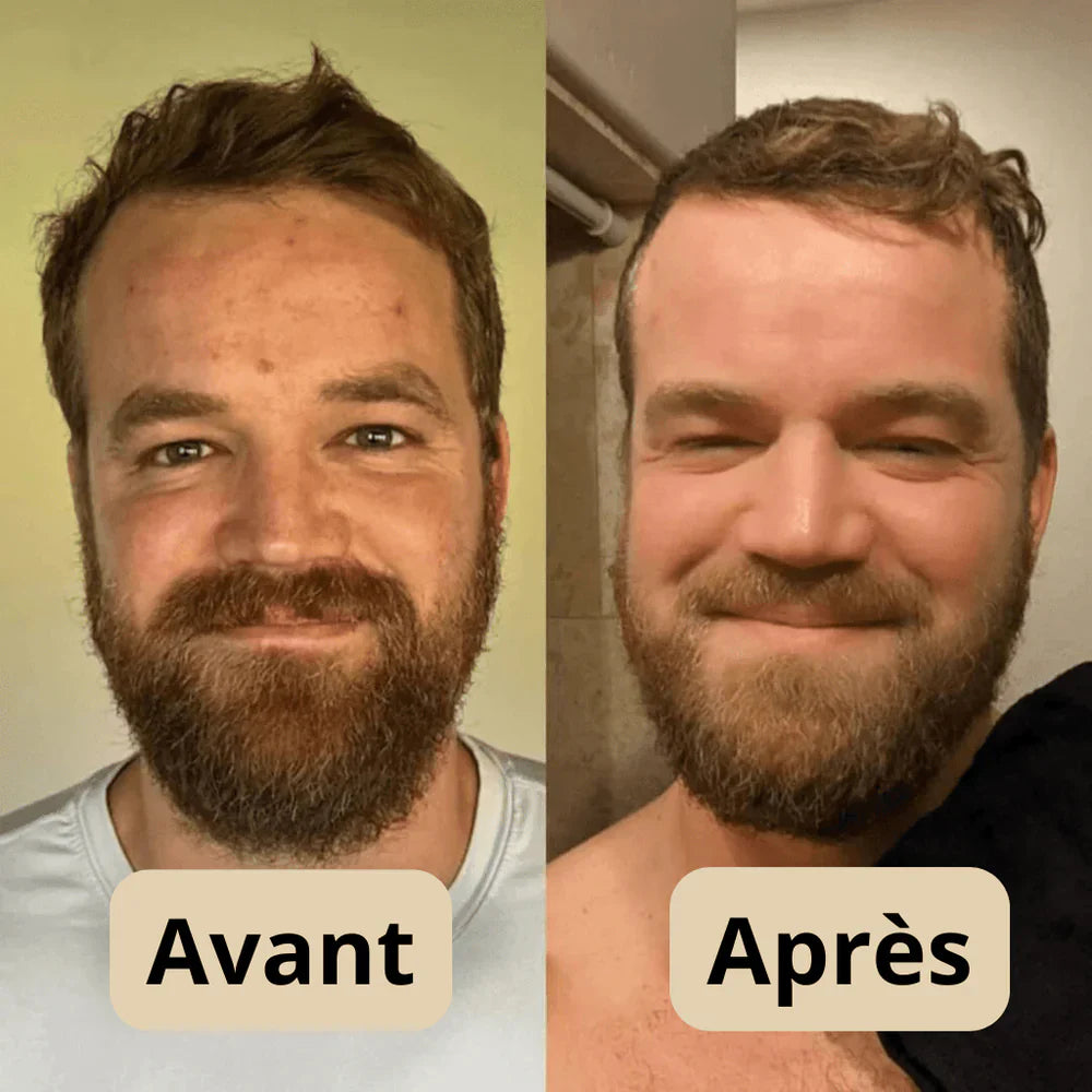 Sérum Gommant au Riz – Pour Peaux Sensibles