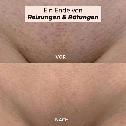 2-in-1-Elektro-Körpertrimmer