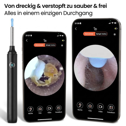 Nettoyeur d’Oreilles Visuel HD avec Caméra Intégrée