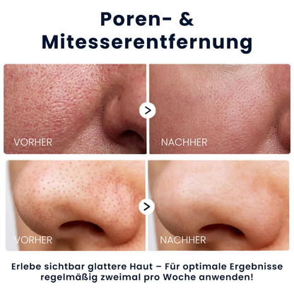 Reis-Peeling-Serum