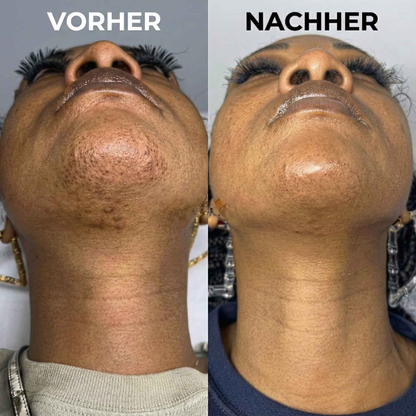 Sérum végétal pour ralentir la pousse des cheveux