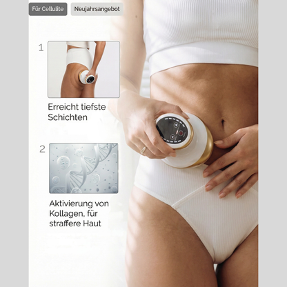 Anti-Cellulite-Gerät mit Wärme- und Massagefunktion