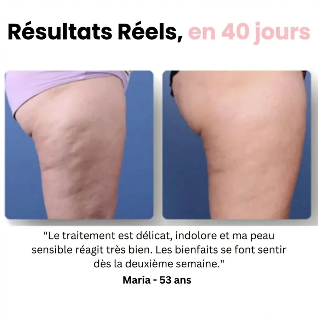 Elektrisches Anti-Cellulite-Massagegerät mit Drainagefunktion