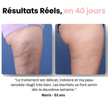 Elektrisches Anti-Cellulite-Massagegerät mit Drainagefunktion