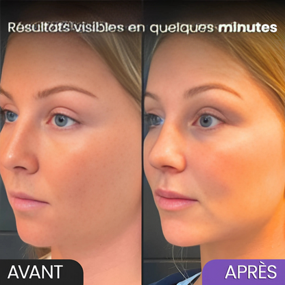 Outil raffermissant visage