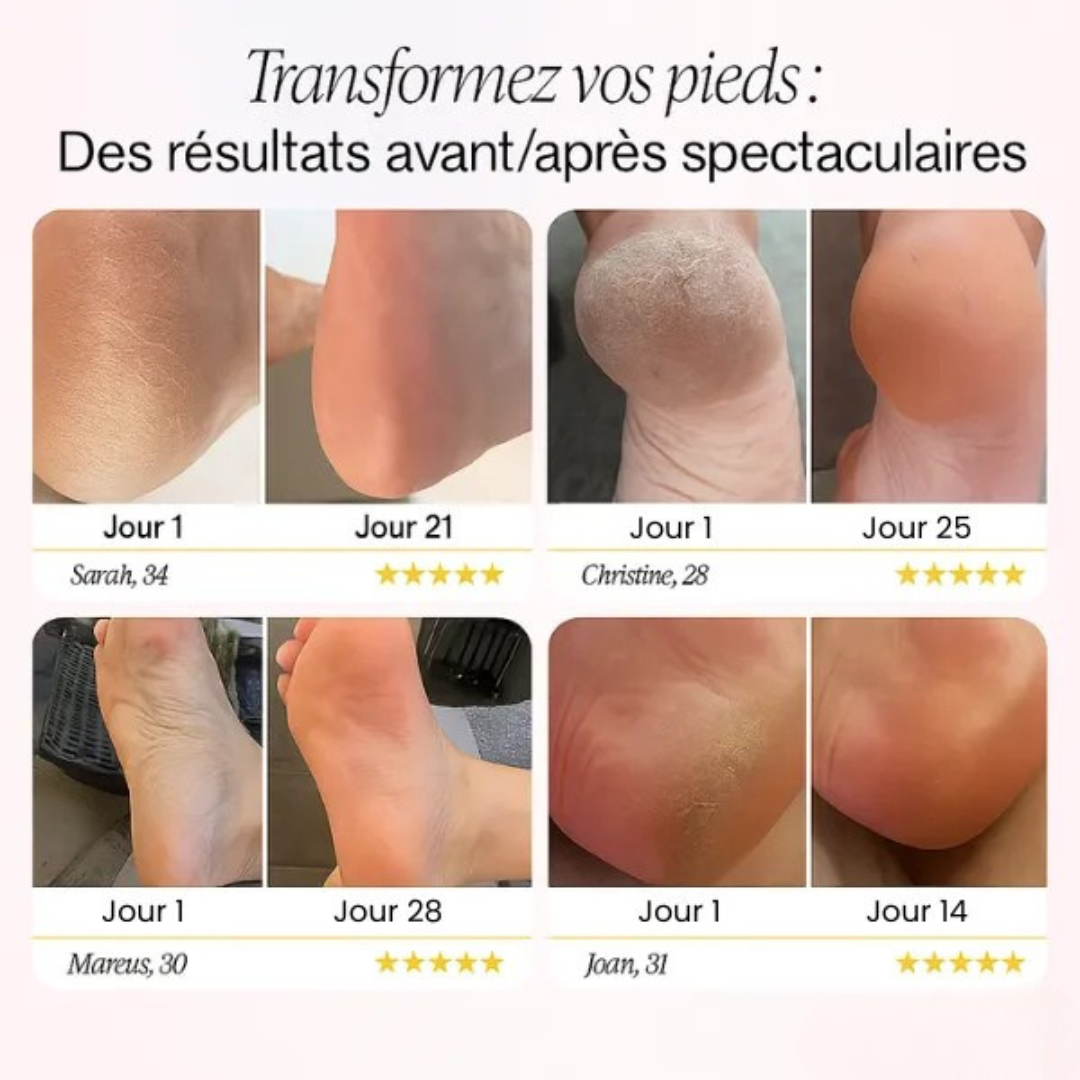 Râpe électrique pieds