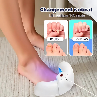 Dispositif LED anti-mycose ongles – Soins rapides et naturels