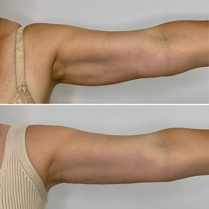 Sérum raffermissant bras & jambes