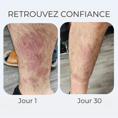 Crème anti-démangeaisons naturelle multi-zones