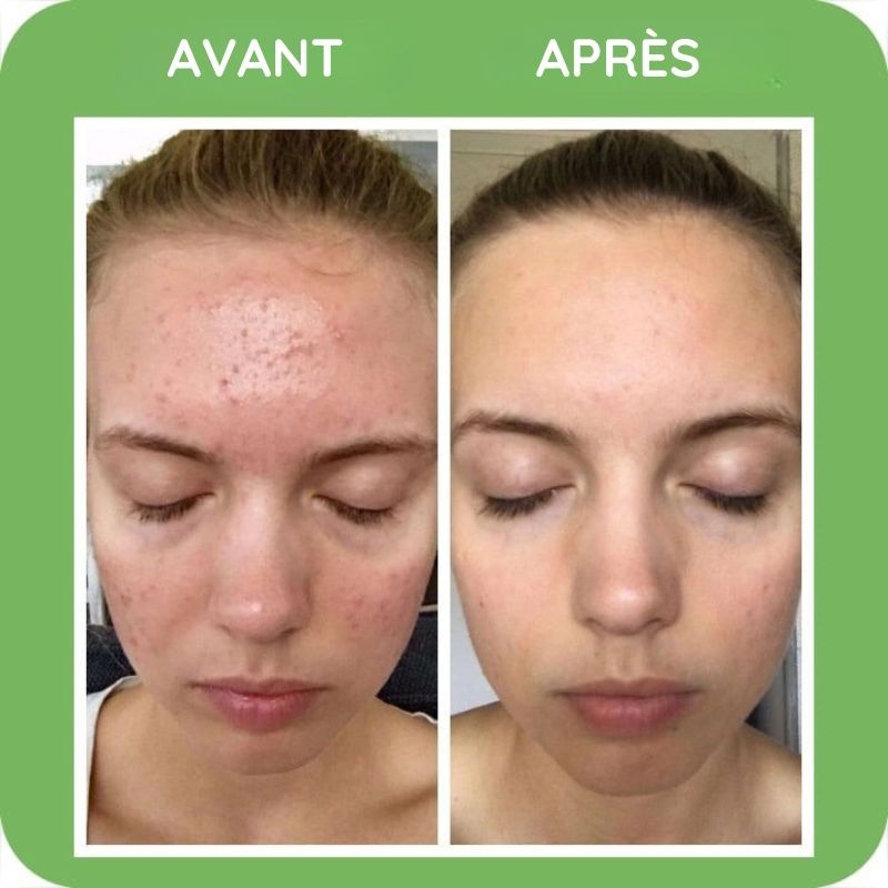 Reinigende Maske mit grünem Tee