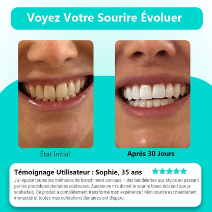 Brosse à dents sonique 360°