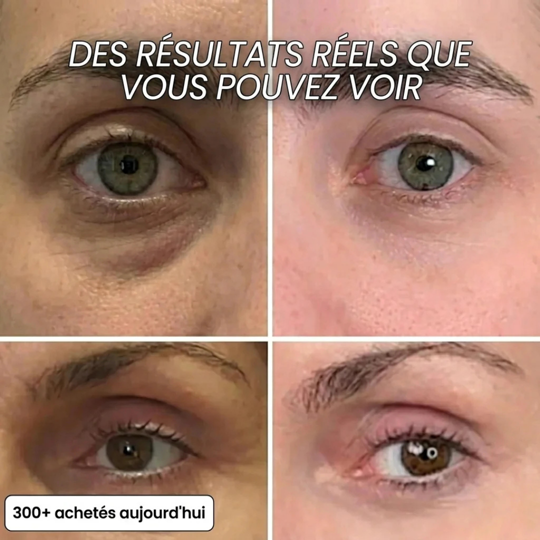 Stick collagène PDRN anti-âge visage
