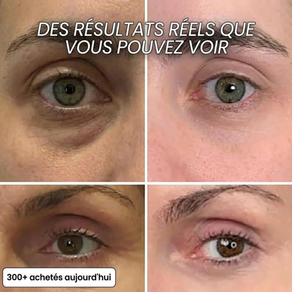 Stick collagène PDRN anti-âge visage