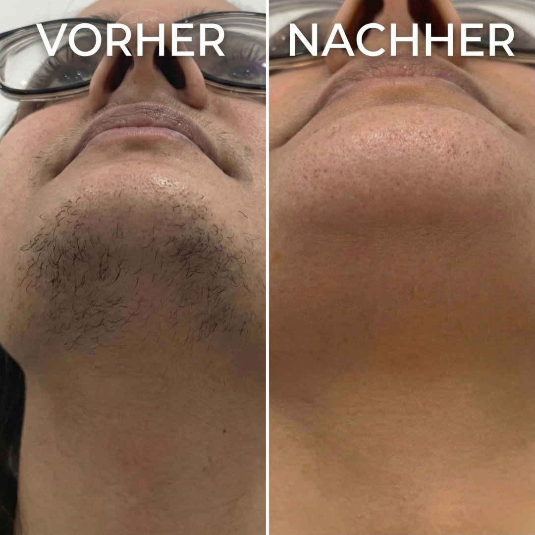 Sérum végétal pour ralentir la pousse des cheveux