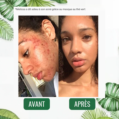 Masque Solide au Thé Vert