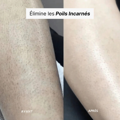 Rasoir électrique femme – Douceur express sans irritation