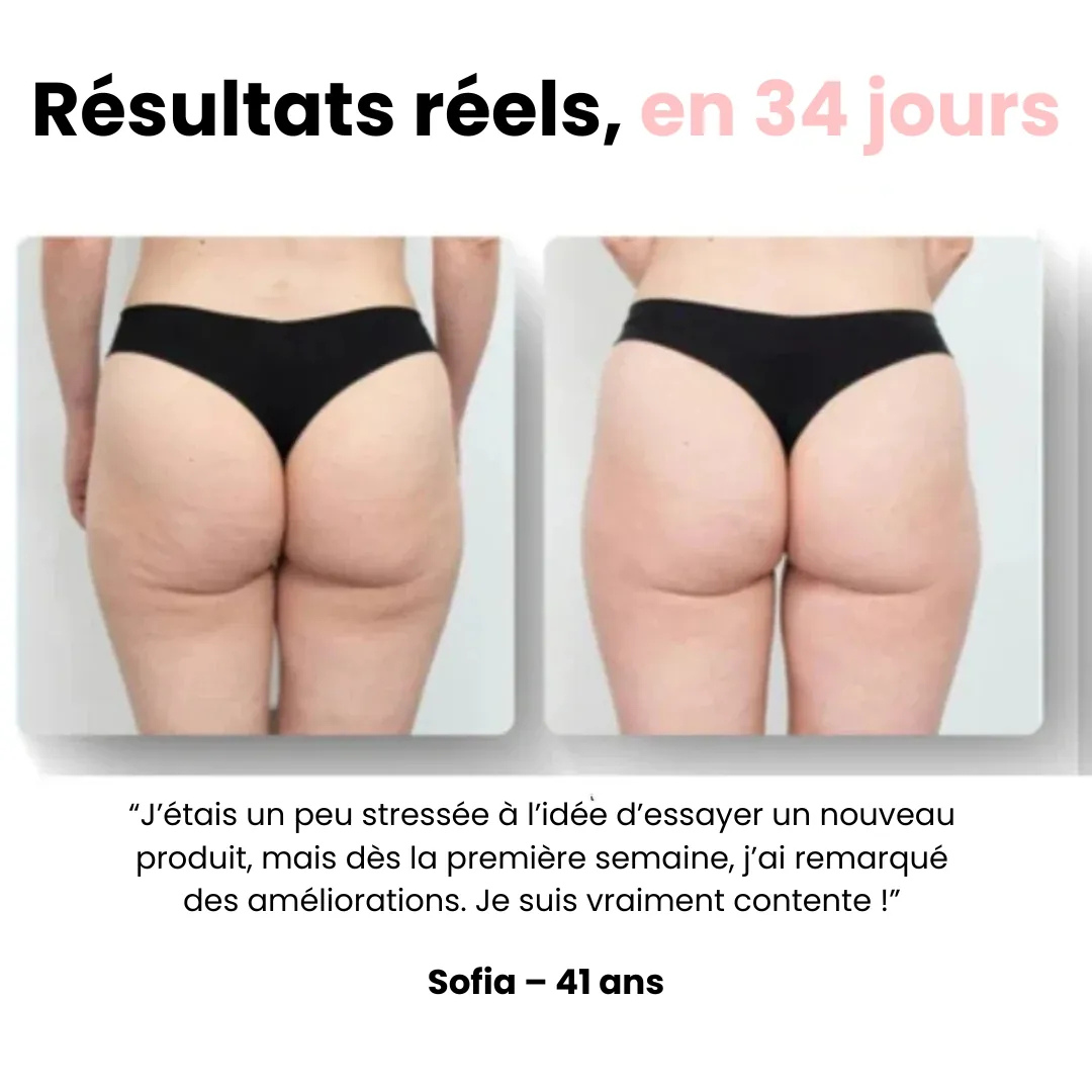 Elektrisches Anti-Cellulite-Massagegerät mit Drainagefunktion
