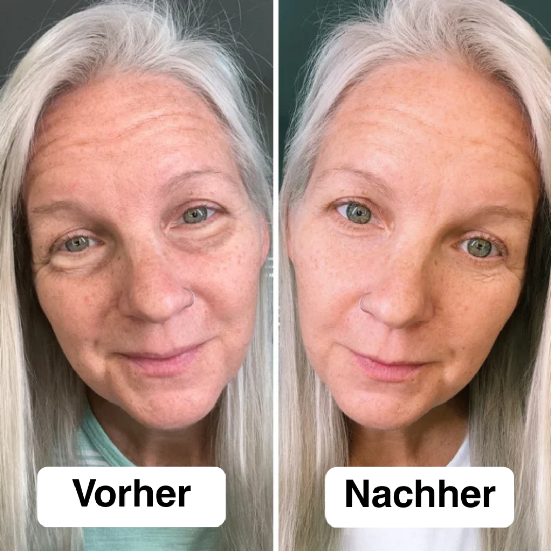 Appareil de Tonification du Visage