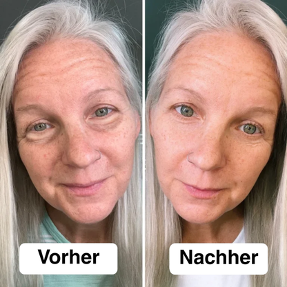 Appareil de Tonification du Visage