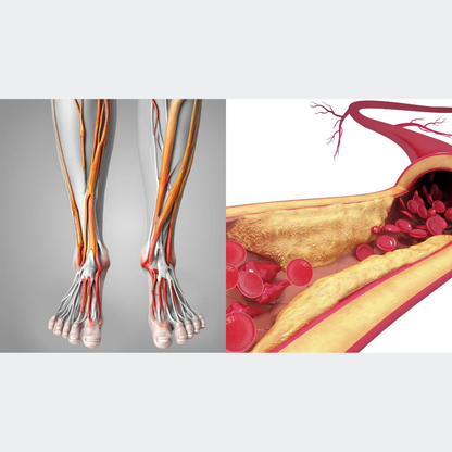 Vibrationsgerät gegen Neuropathie