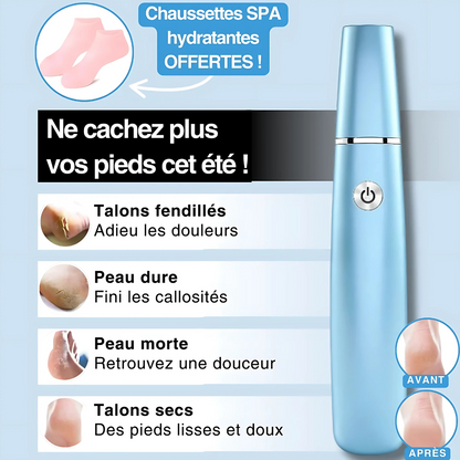 Râpe Électrique Rechargeable pour Pieds