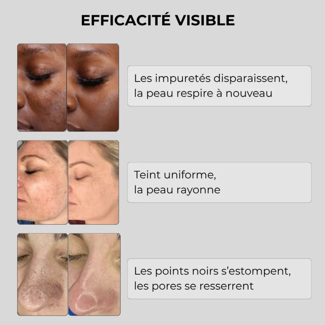 Sérum Correcteur Éclat