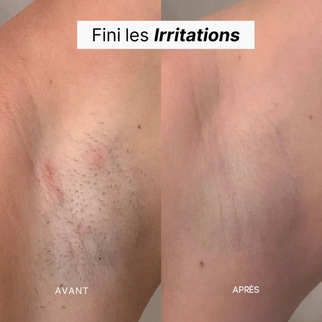 Rasoir électrique femme – Douceur express sans irritation