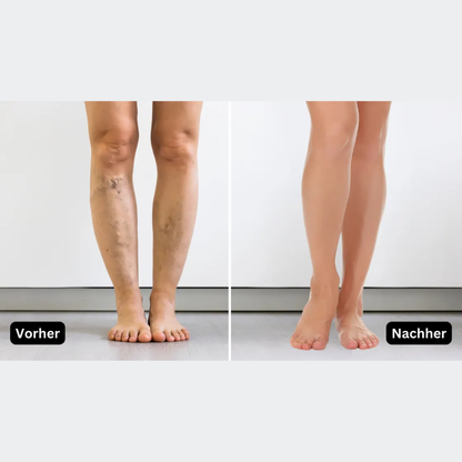 Vibrationsgerät gegen Neuropathie