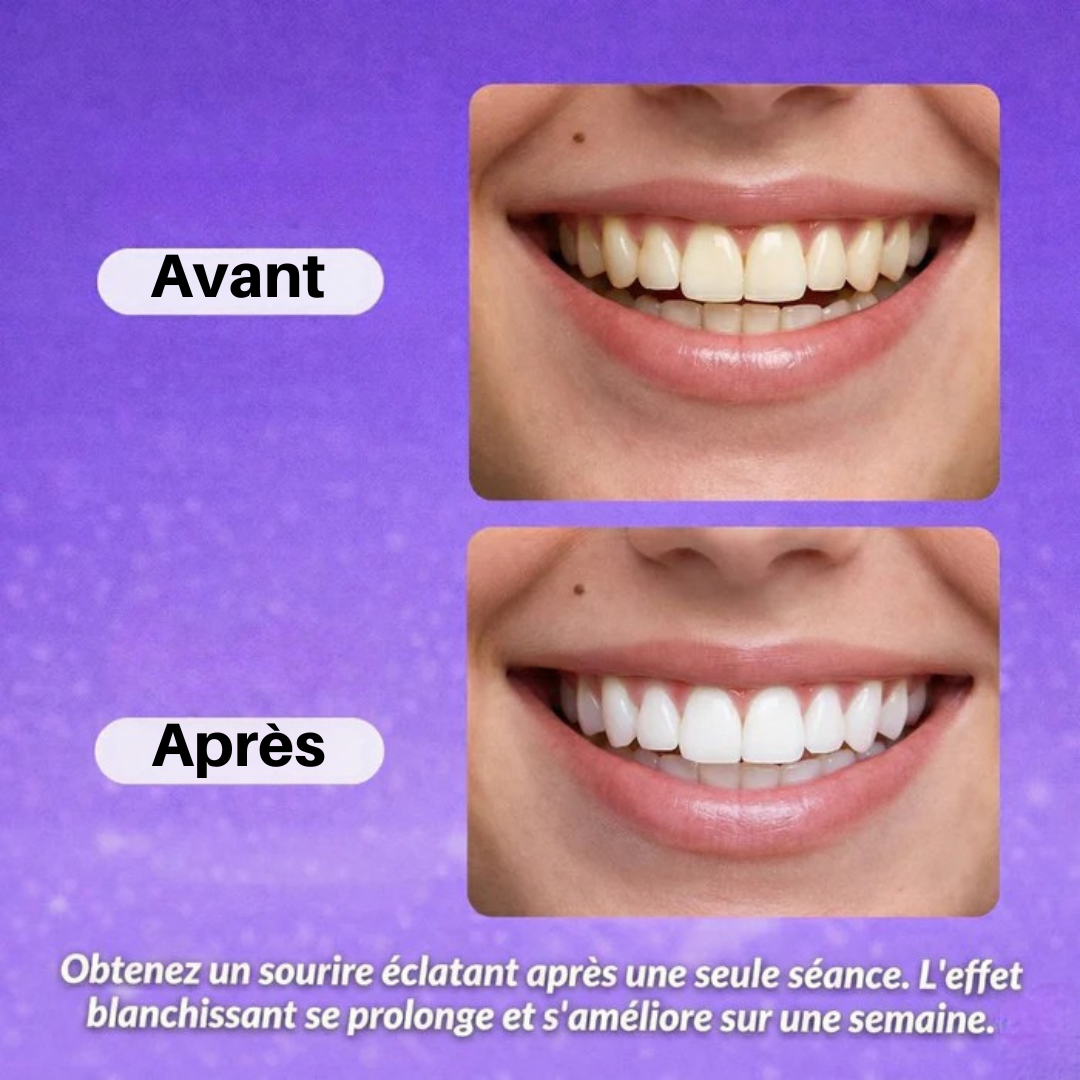 Zahnaufhellungsstreifen