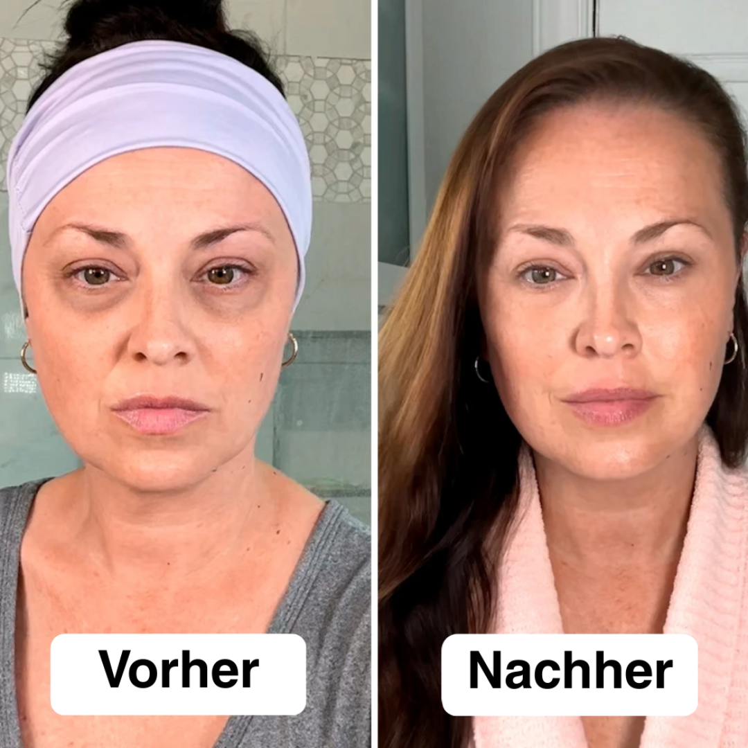 Appareil de Tonification du Visage