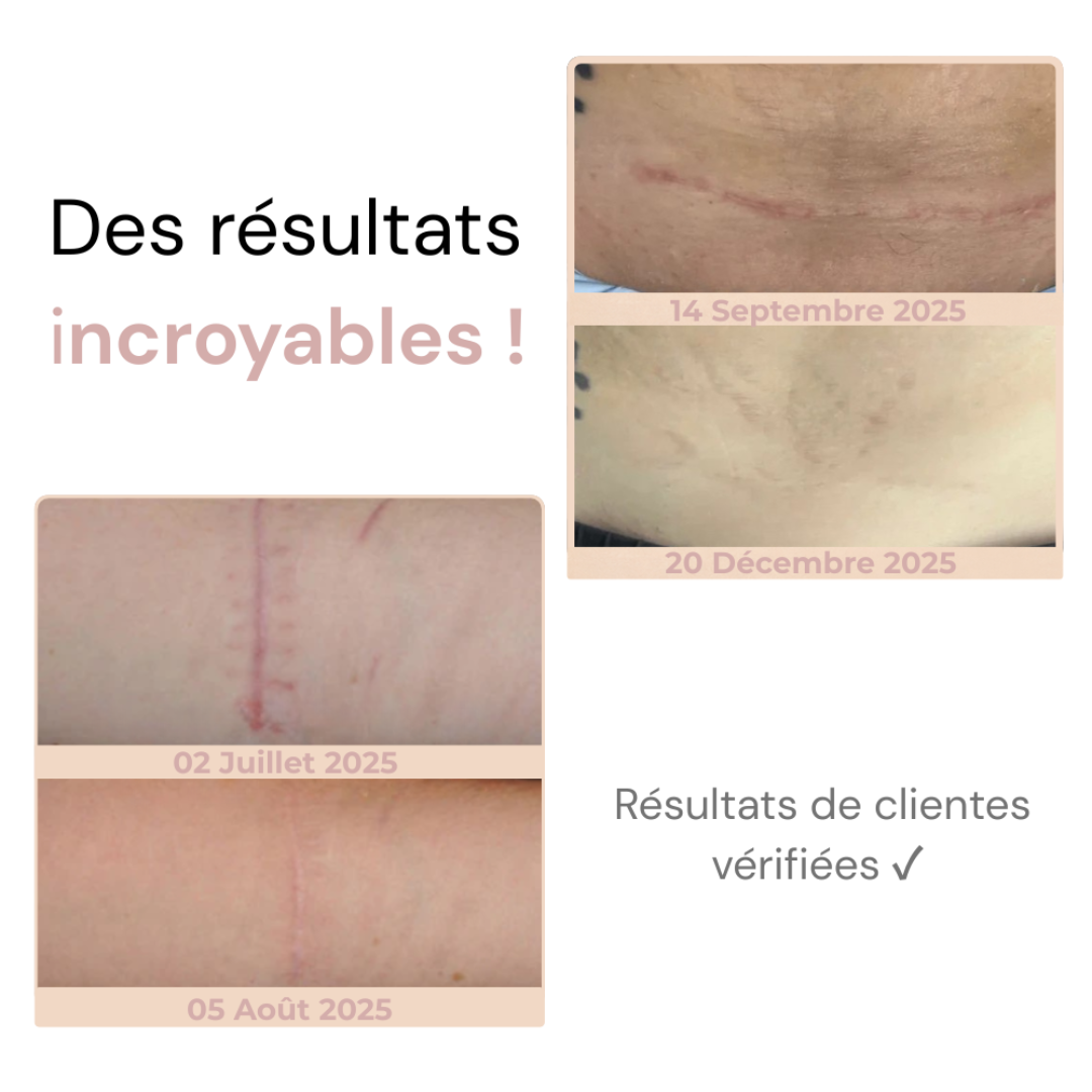 Silikon-Reparaturstift für Narben