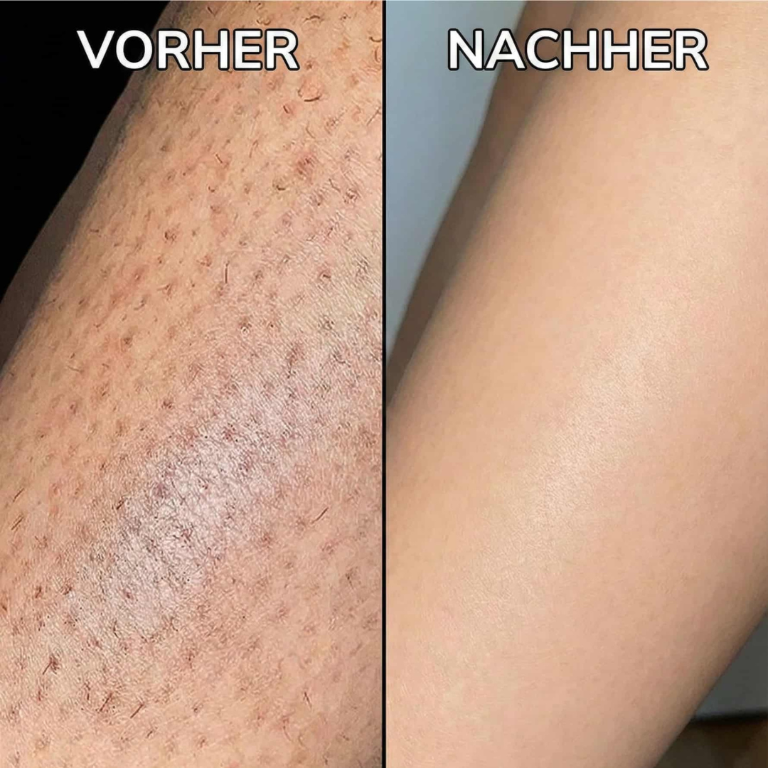 Sérum végétal pour ralentir la pousse des cheveux