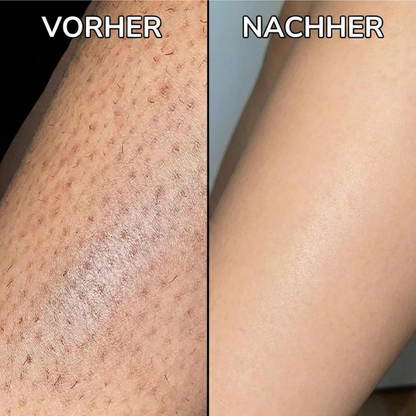 Sérum végétal pour ralentir la pousse des cheveux