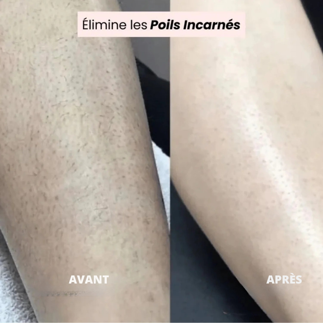 Rasoir électrique zones sensibles