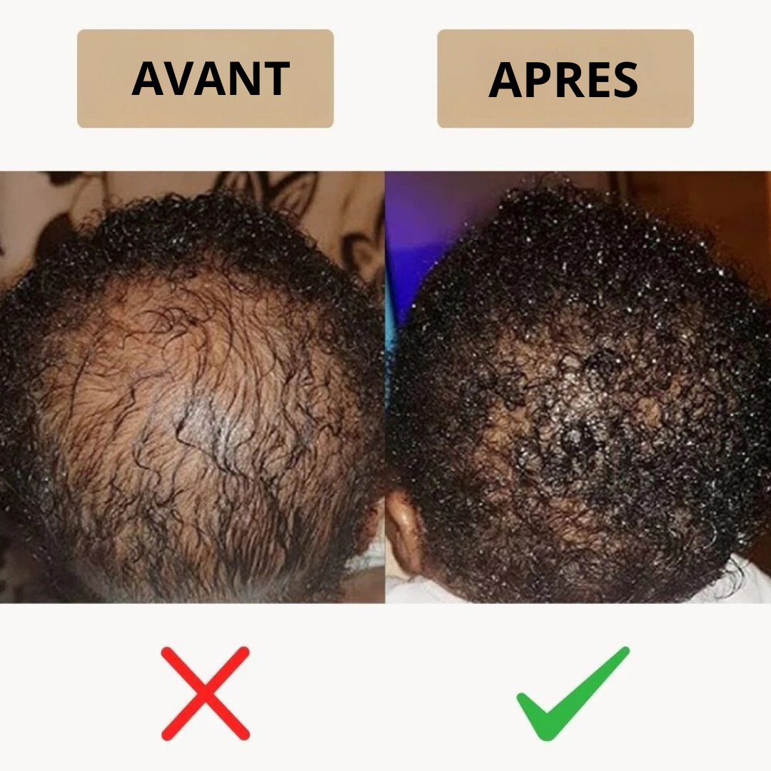 Soin capillaire nourrissant